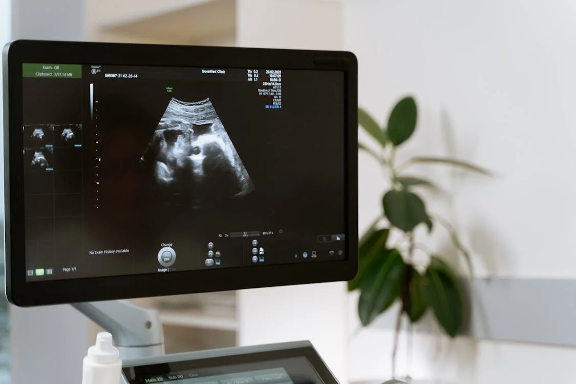 Sonography